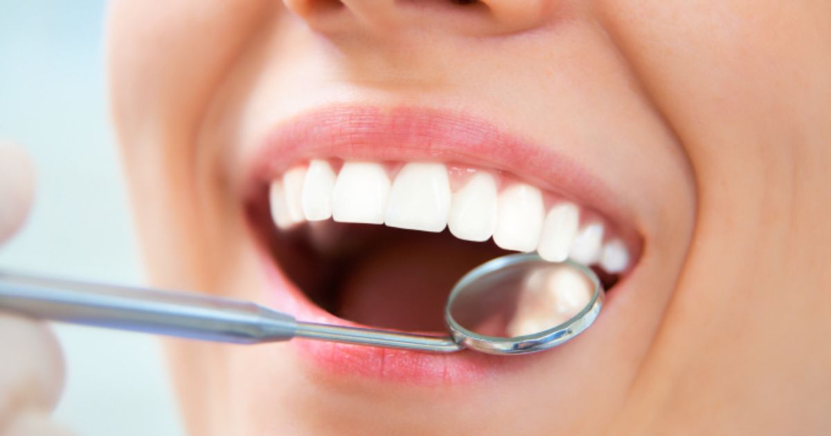 Rehabilitación oral: La importancia de invertir en nuestros dientes