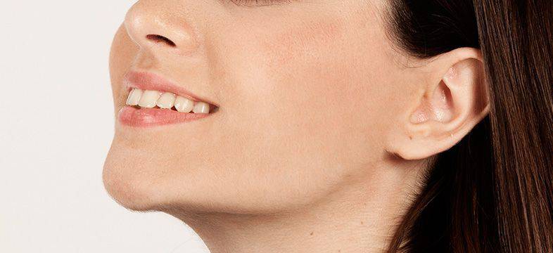 Otoplastía Otoplastía