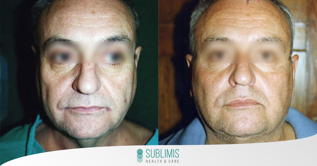 Plastic surgery in argentina
