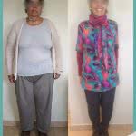 Cirugia Bariatrica en Mujer Antes y Despues