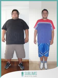 Resultados Bypass Gastrico