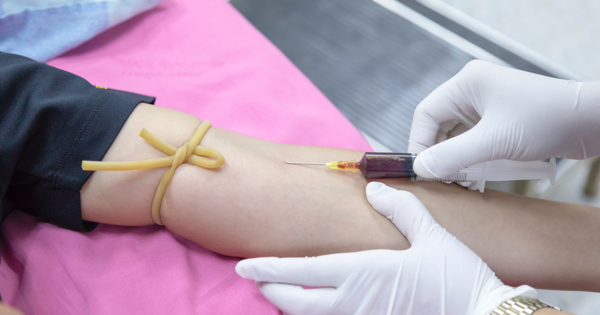 La Solución Para Que Siempre Luzcas Un Rostro Rejuvenecido: Plasma Rico en Plaquetas