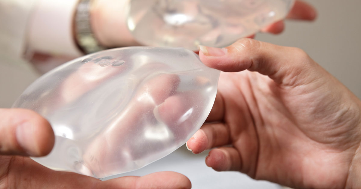 Riesgos asociados a los Implantes Mamarios: BIA-ALCL